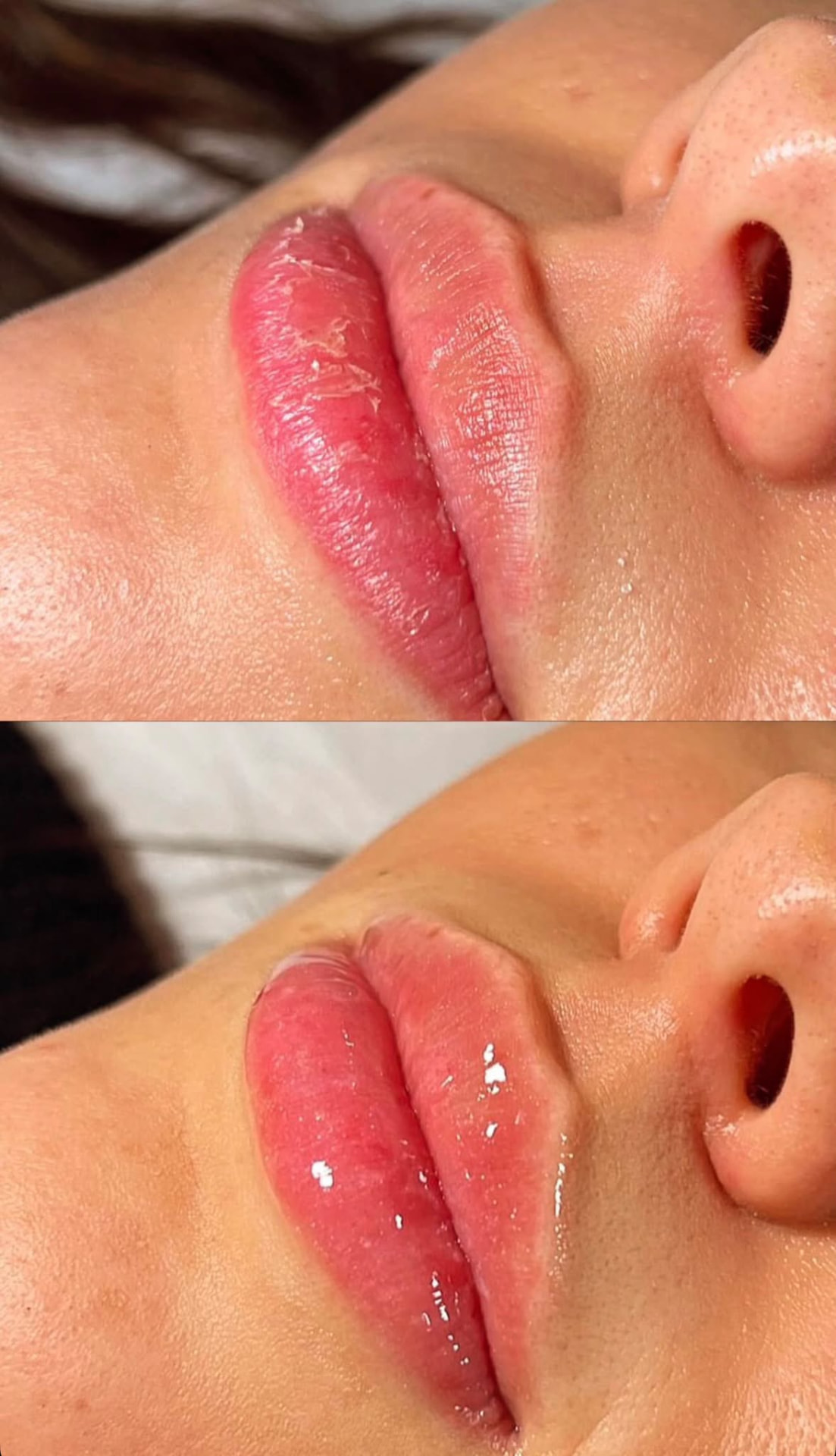 Rezultat LIPS Z tretmana — hidrirane i glatke usne